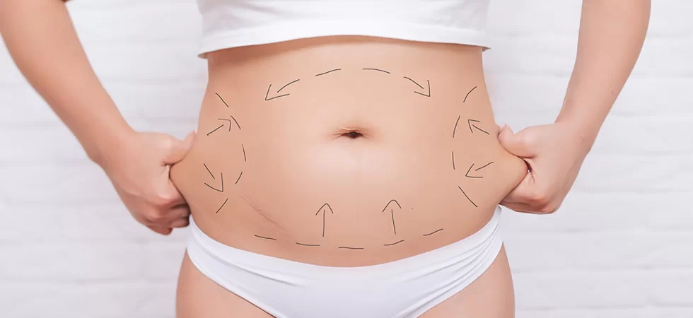 Tummy Tuck at Aestanbul